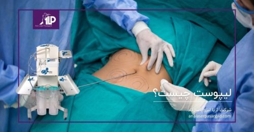 لیپوست چیست؟